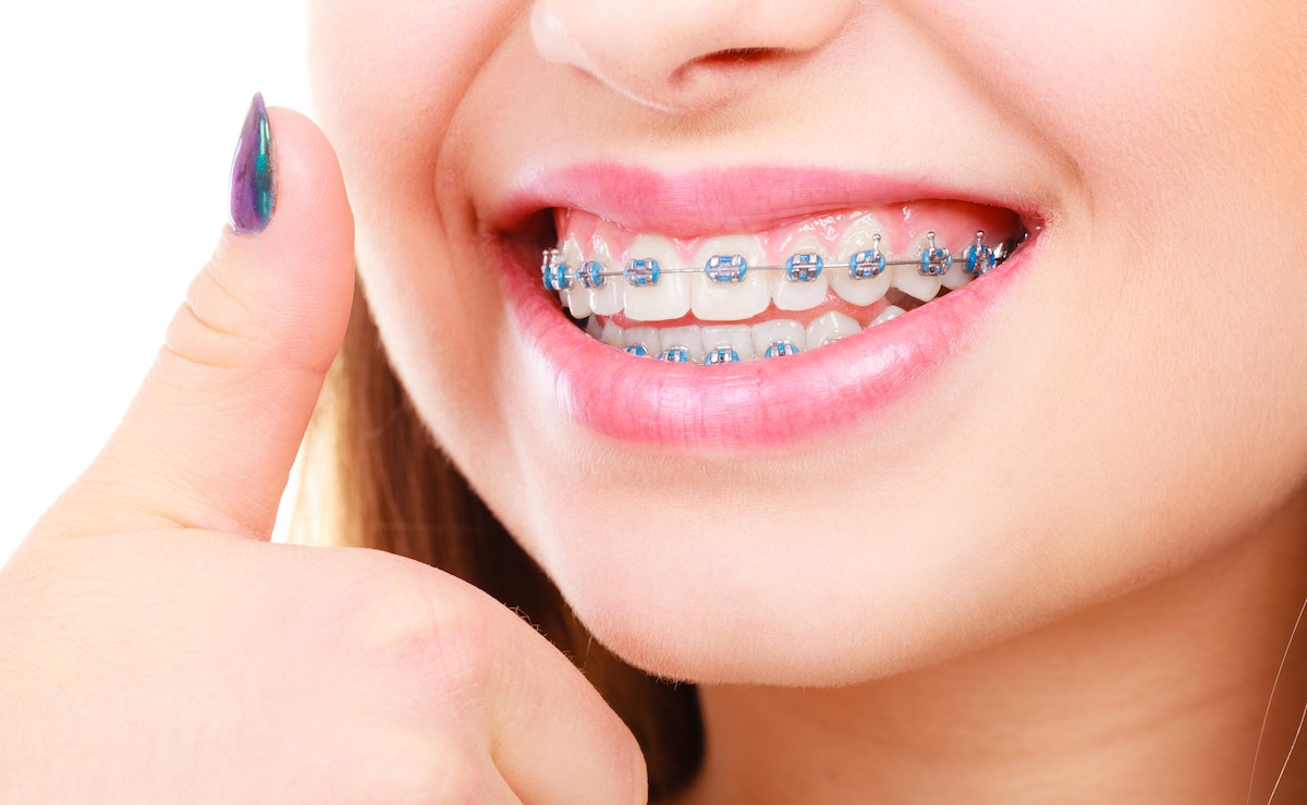 orthodontics prevention in karaikudi